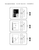 HIP SURGERY SYSTEMS AND METHODS diagram and image