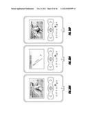 HIP SURGERY SYSTEMS AND METHODS diagram and image