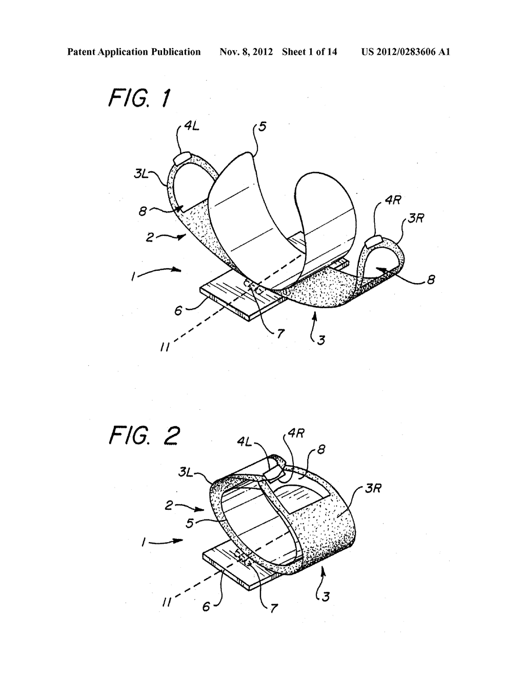 Resuscitation Device with Expert System - diagram, schematic, and image 02