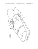 Resuscitation Device with Expert System diagram and image