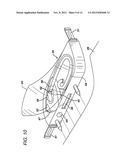 Resuscitation Device with Expert System diagram and image