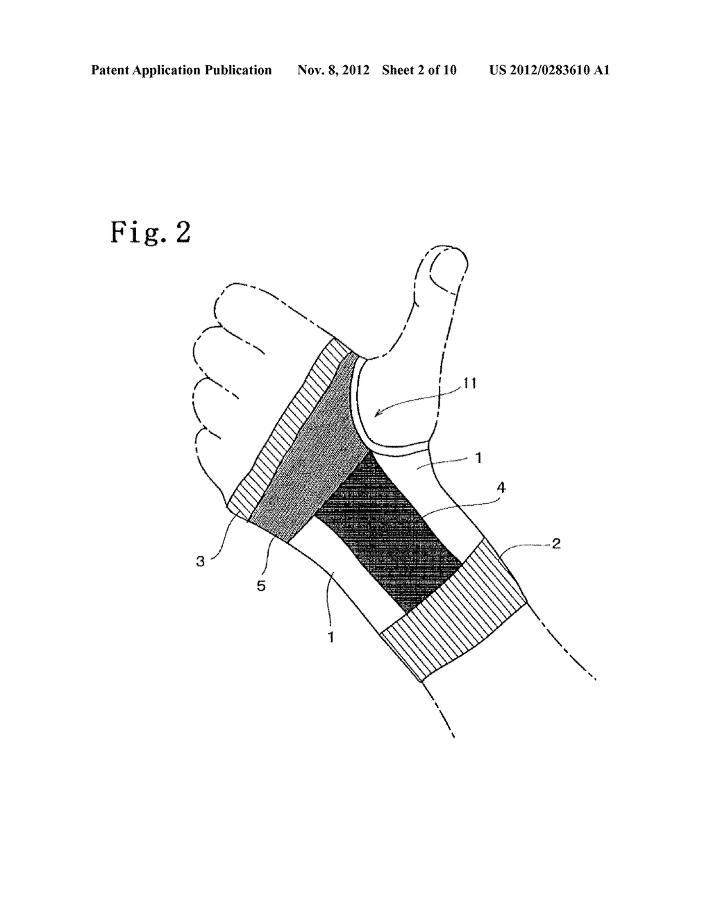 HAND JOINT SUPPORTER - diagram, schematic, and image 03