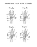 HAND JOINT SUPPORTER diagram and image