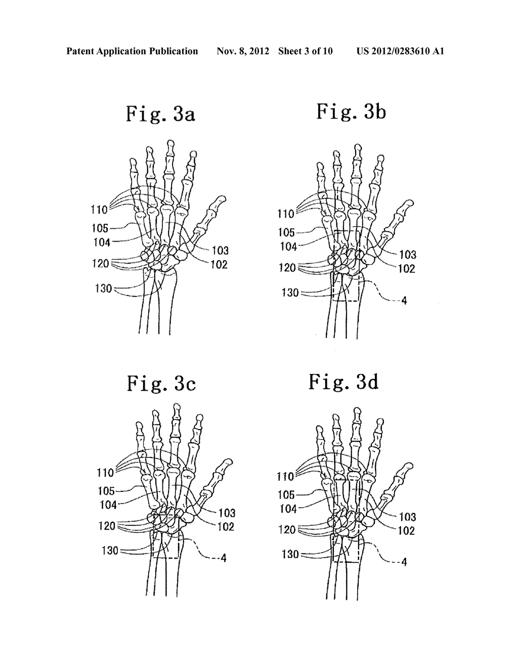 HAND JOINT SUPPORTER - diagram, schematic, and image 04
