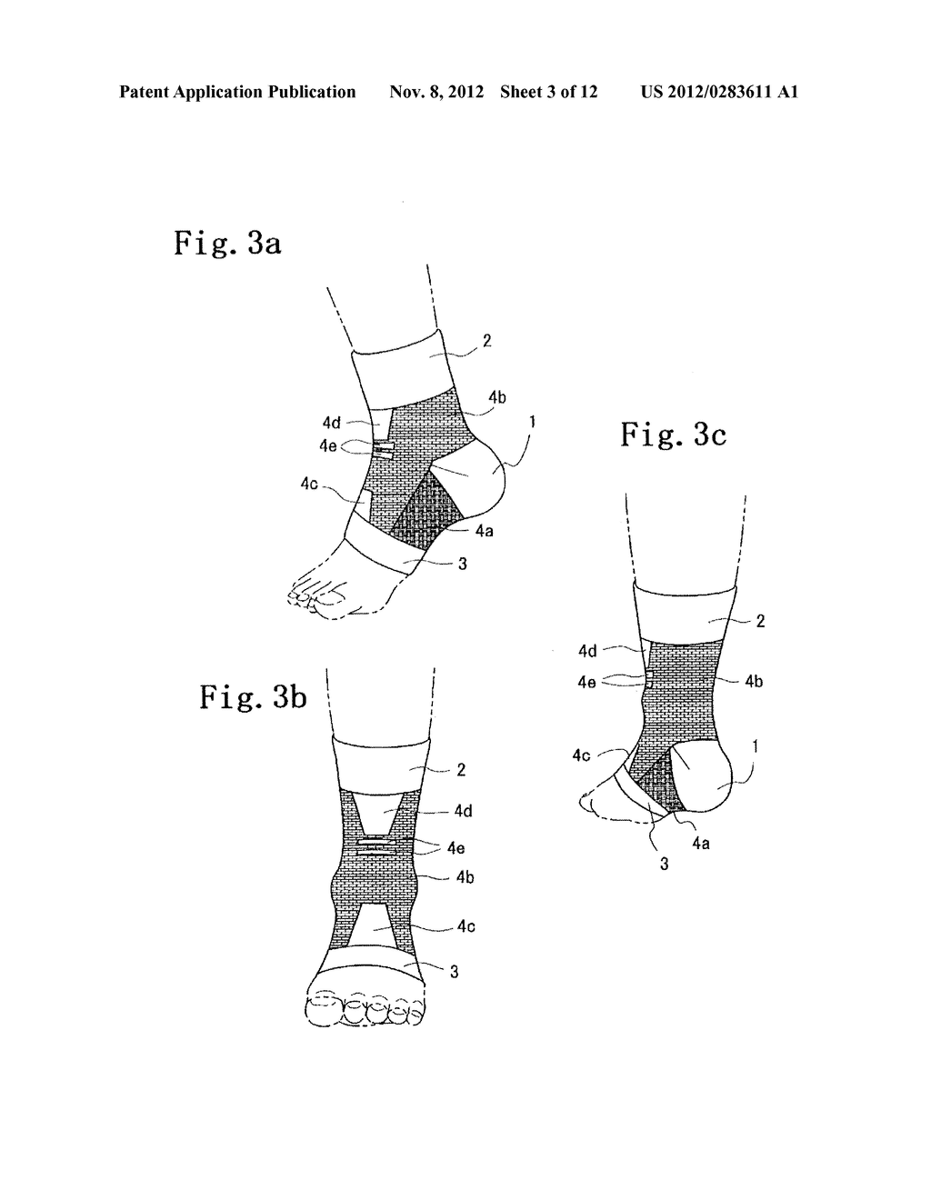 FOOT JOINT SUPPORTER - diagram, schematic, and image 04