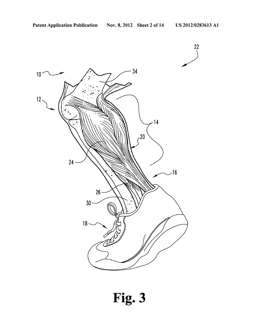 Hinged Equinus Brace With Pediatric, Diabetic and Clubfoot Versions - diagram, schematic, and image 03