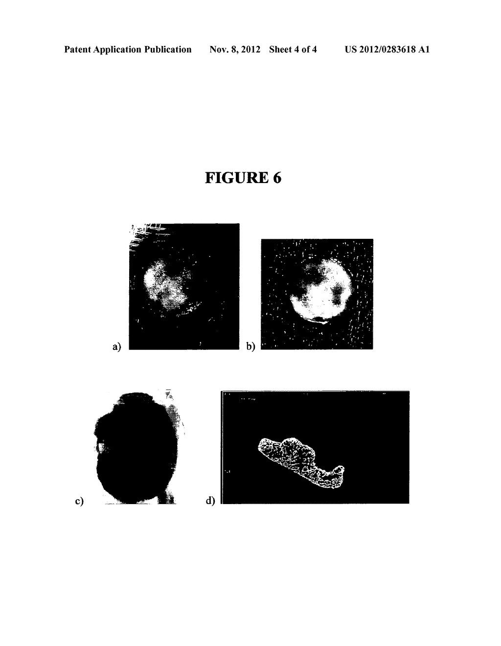 Method of Inducing Cellular Growth and Materials for Use Therewith - diagram, schematic, and image 05