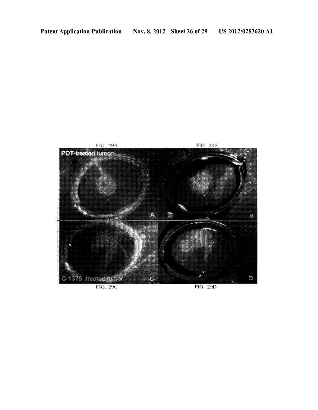 TREATMENT UTILIZING HYDROPHOBIC WEAK BASES CHEMOTHERAPEUTIC AGENTS AND     ILLUMINATION - diagram, schematic, and image 27