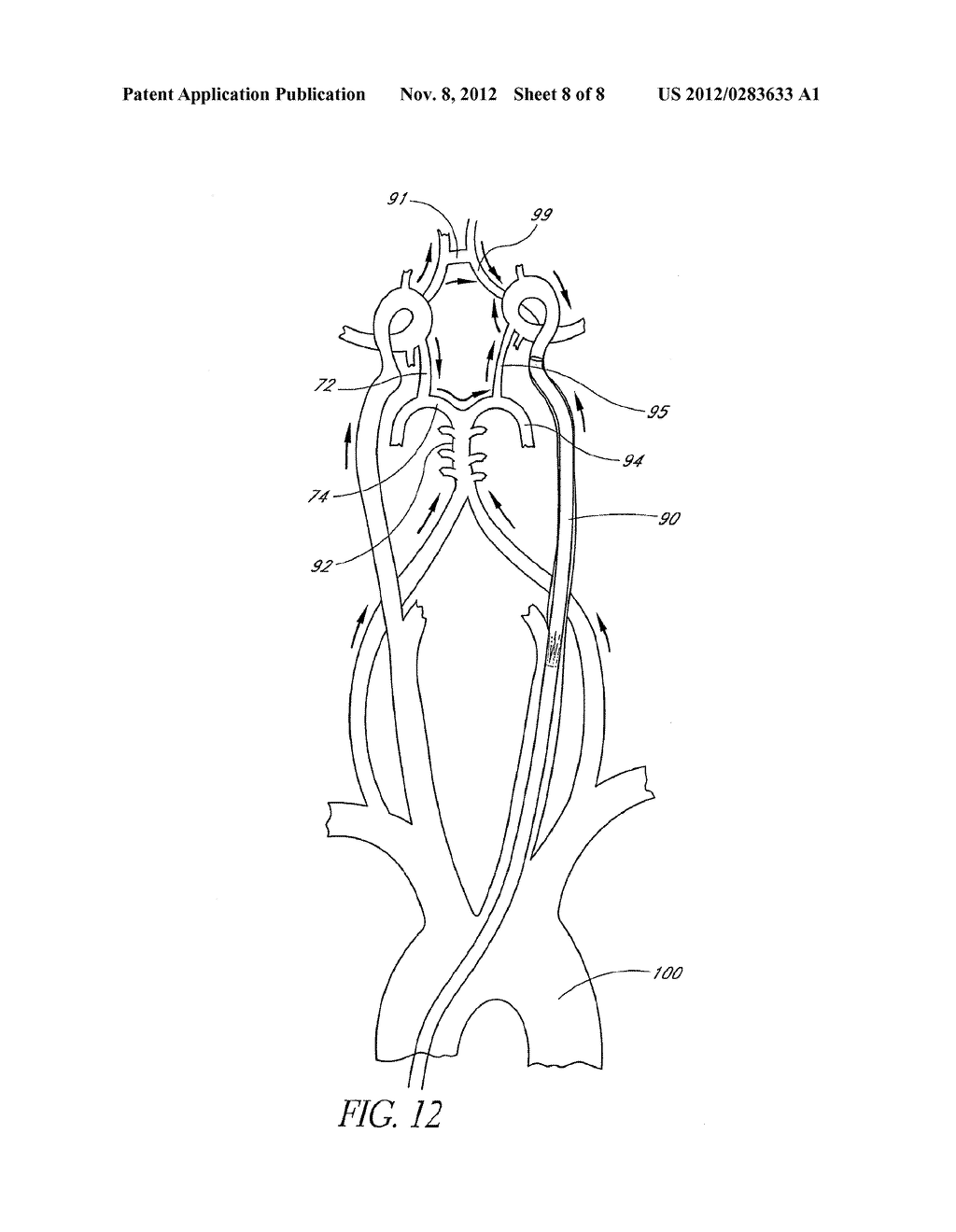 INTRAVASCULAR ACCESS CATHETER - diagram, schematic, and image 09