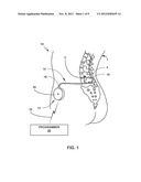 DETECTING EMPTY MEDICAL PUMP RESERVOIR diagram and image