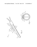 Temporary Retention Device diagram and image