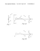 Temporary Retention Device diagram and image