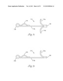 Temporary Retention Device diagram and image