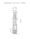 Temporary Retention Device diagram and image