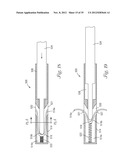 Temporary Retention Device diagram and image