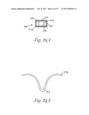 Temporary Retention Device diagram and image