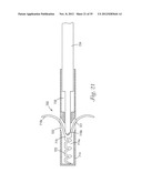 Temporary Retention Device diagram and image