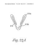 Temporary Retention Device diagram and image