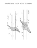 Temporary Retention Device diagram and image