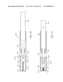 Temporary Retention Device diagram and image