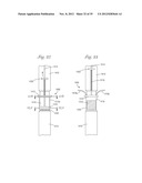 Temporary Retention Device diagram and image