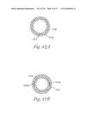 Temporary Retention Device diagram and image