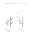 Temporary Retention Device diagram and image