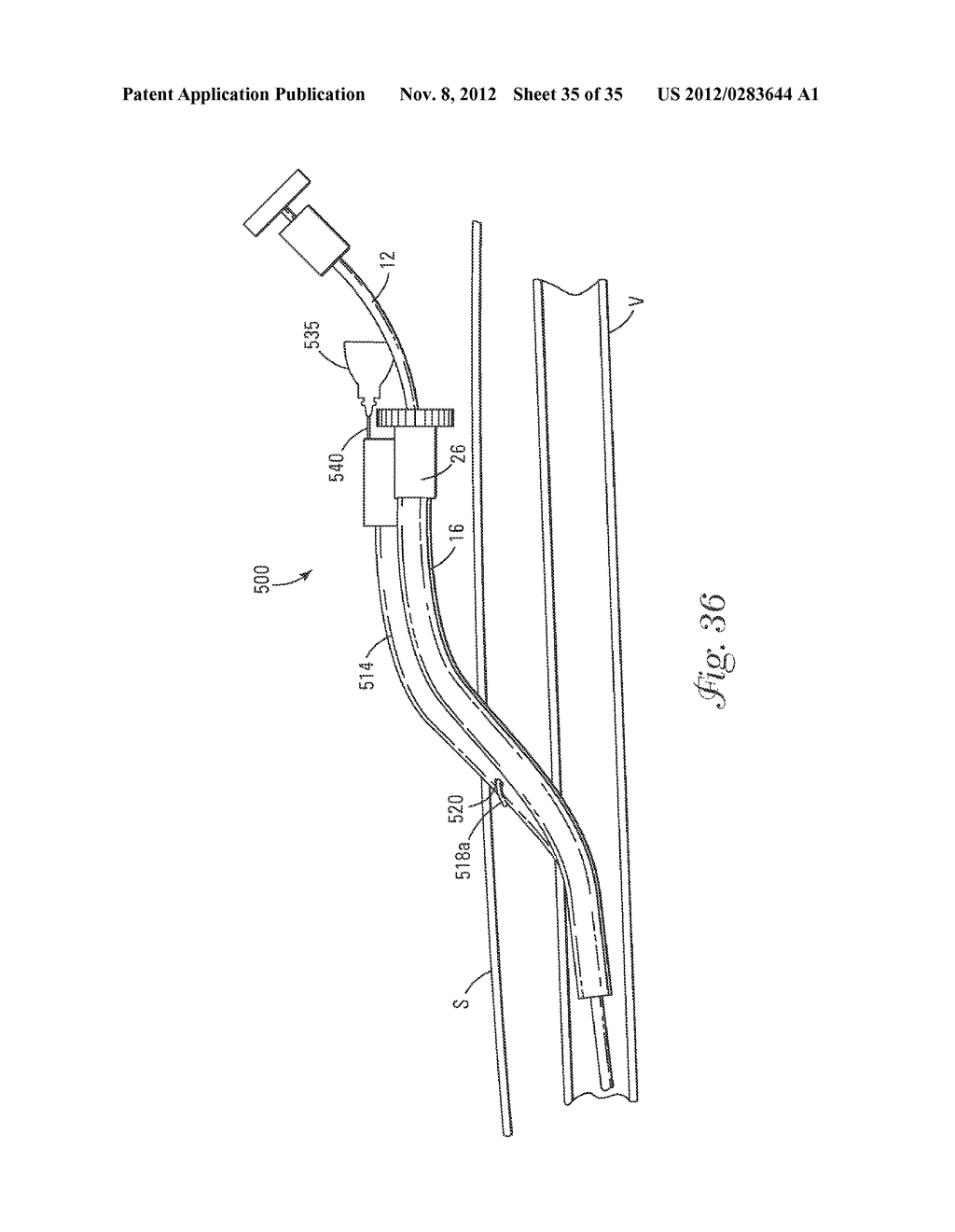 Temporary Retention Device - diagram, schematic, and image 36