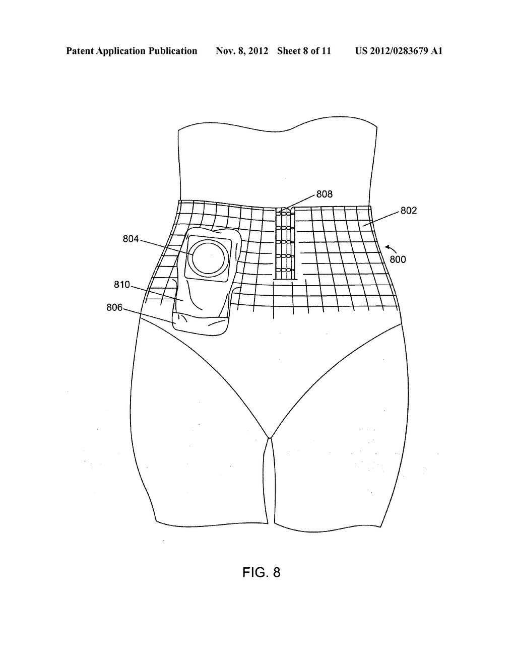 Belly binder with a reinforced opening - diagram, schematic, and image 09