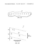 Devices and Methods for Radiation-Based Dermatological Treatments diagram and image