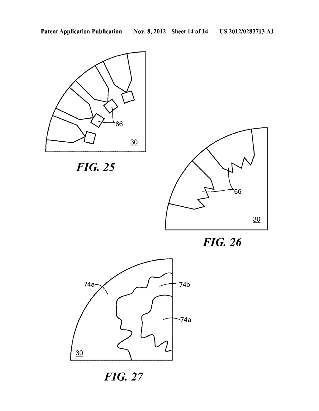 COMPLIANT SLEEVES COUPLED WITH WIRE STRUCTURES FOR CRYOABLATION - diagram, schematic, and image 15