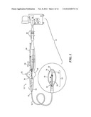 ELECTRICAL SENSING SYSTEMS AND METHODS OF USE FOR TREATING TISSUE diagram and image