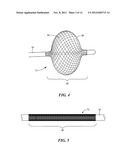 ELECTRICAL SENSING SYSTEMS AND METHODS OF USE FOR TREATING TISSUE diagram and image