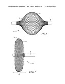 ELECTRICAL SENSING SYSTEMS AND METHODS OF USE FOR TREATING TISSUE diagram and image