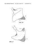 ELECTRICAL SENSING SYSTEMS AND METHODS OF USE FOR TREATING TISSUE diagram and image