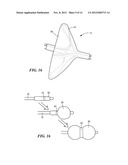 ELECTRICAL SENSING SYSTEMS AND METHODS OF USE FOR TREATING TISSUE diagram and image