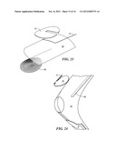 ELECTRICAL SENSING SYSTEMS AND METHODS OF USE FOR TREATING TISSUE diagram and image