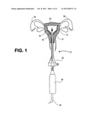 Uterine Therapy Device and Method diagram and image