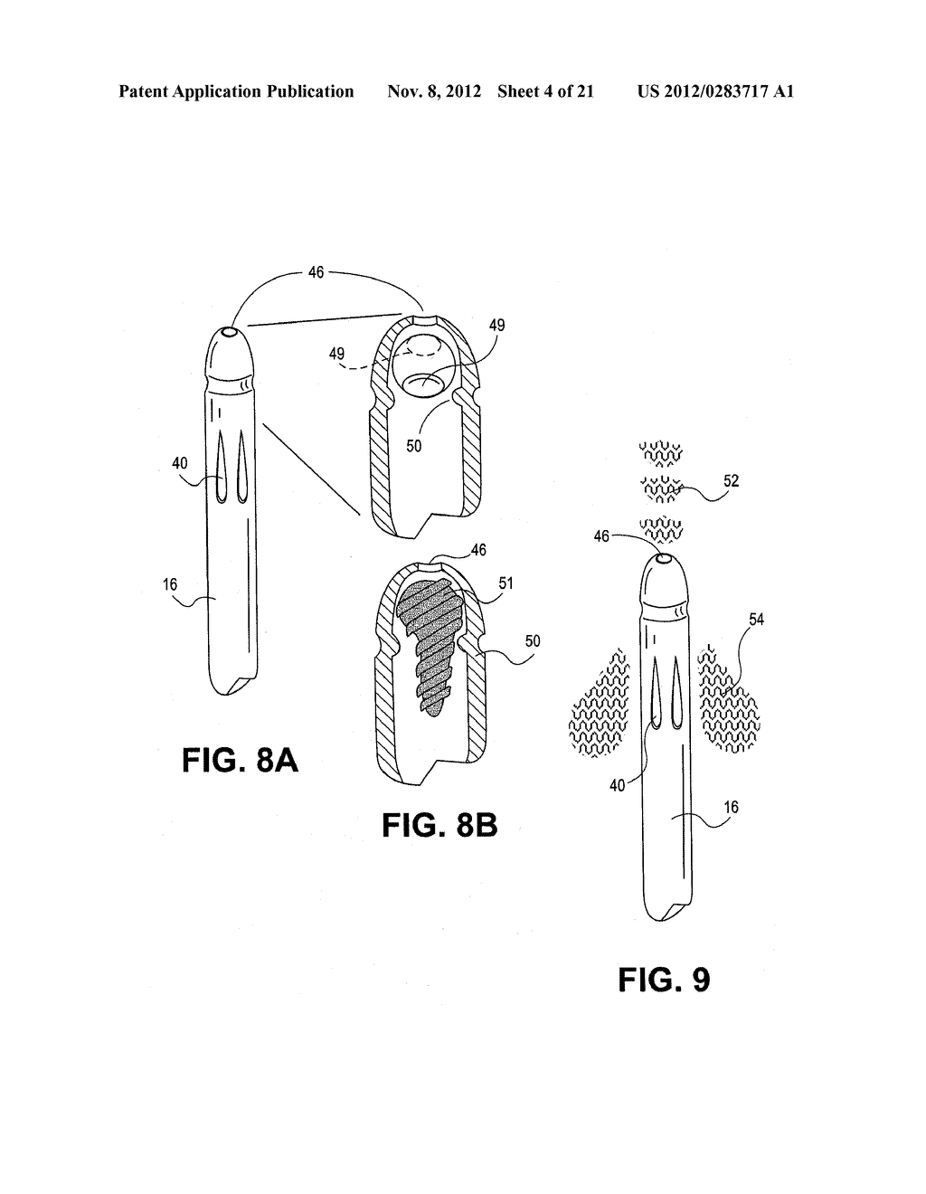 Uterine Therapy Device and Method - diagram, schematic, and image 05