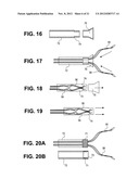 Uterine Therapy Device and Method diagram and image