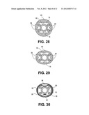 Uterine Therapy Device and Method diagram and image