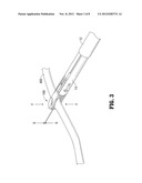 System and Method for Tissue Sealing diagram and image