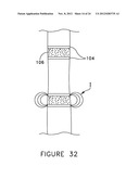 RADIO-FREQUENCY TISSUE WELDER TWO STAGE PRESSURE APPLICATION diagram and image