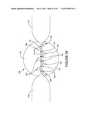 RADIO-FREQUENCY TISSUE WELDER TWO STAGE PRESSURE APPLICATION diagram and image