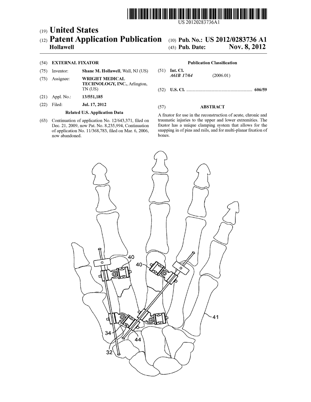 EXTERNAL FIXATOR - diagram, schematic, and image 01