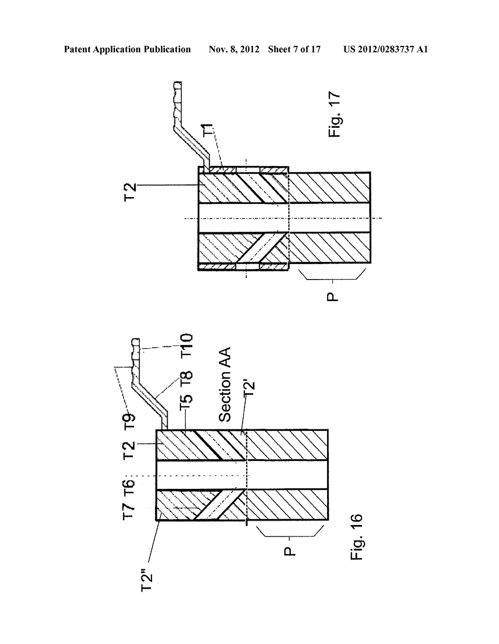 Guide Tube Positioning Method in Polymeric Material Plate, Tomographic     Reference Support and Guide Tube Positioning Device - diagram, schematic, and image 08