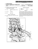 INSERTION TOOL FOR A SPINAL CORD STIMULATION ELECTRODE diagram and image