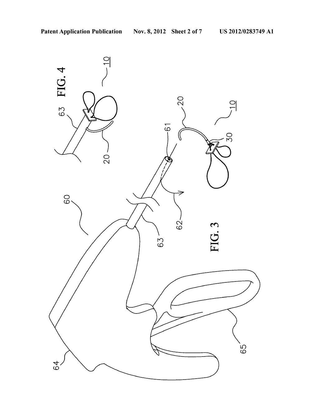 MULTIPLE LOOP DEVICE FOR PASSING SUTURE TAILS THROUGH A SURGICAL PLEDGET - diagram, schematic, and image 03