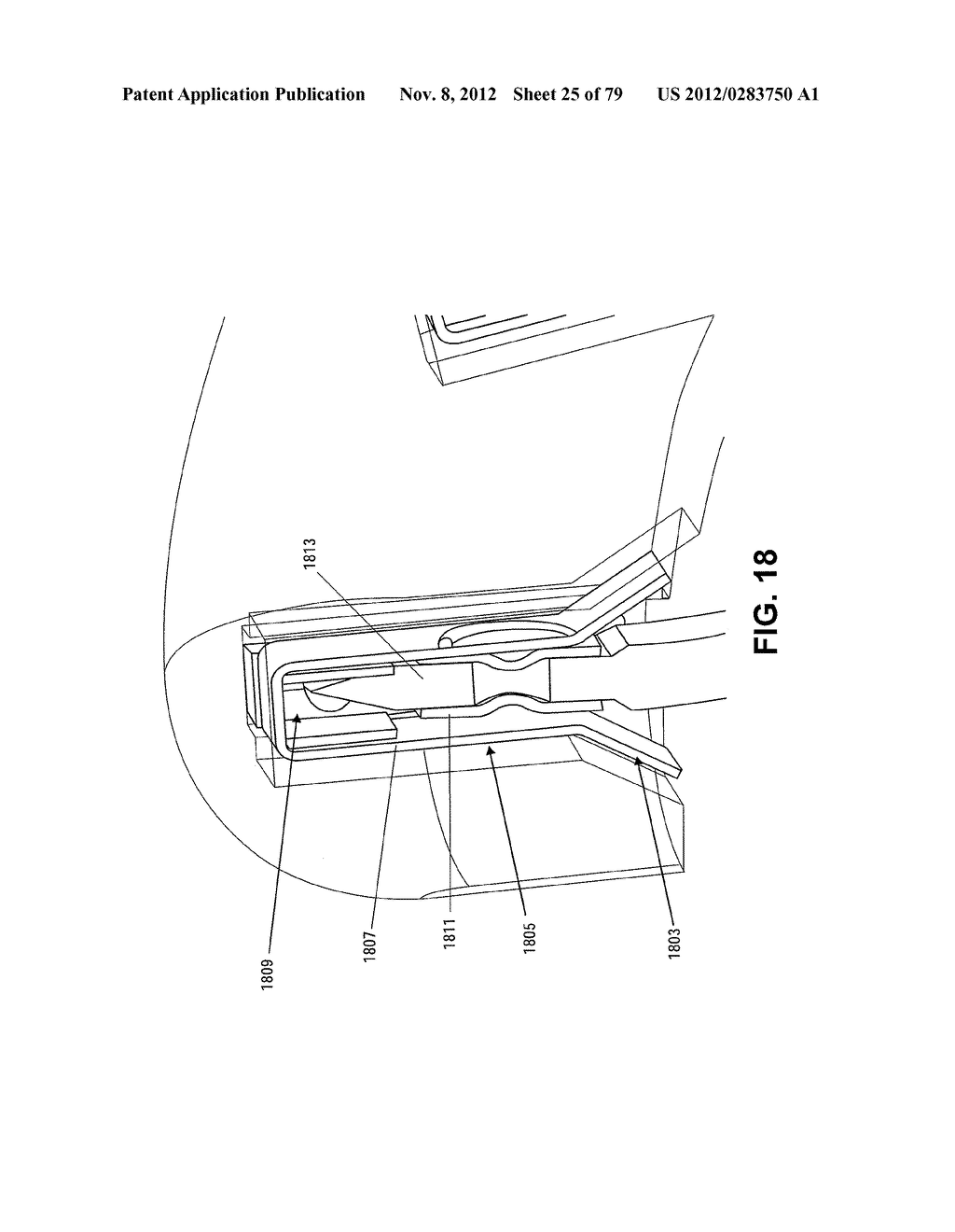 MENISCUS REPAIR - diagram, schematic, and image 26