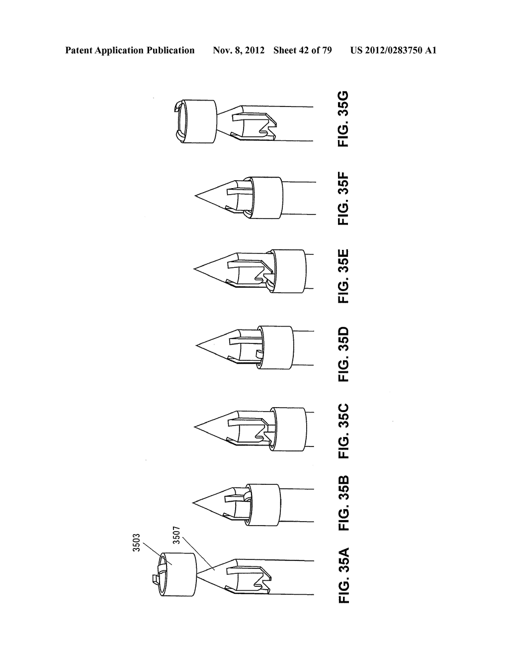 MENISCUS REPAIR - diagram, schematic, and image 43